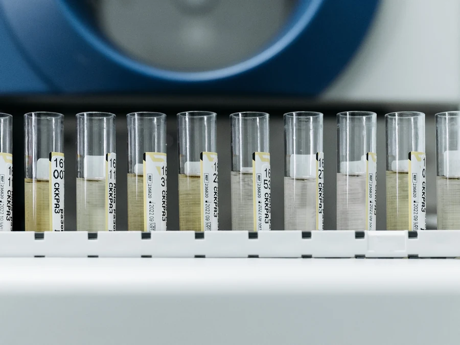 A rack of labelled sample tubes on a laboratory bench